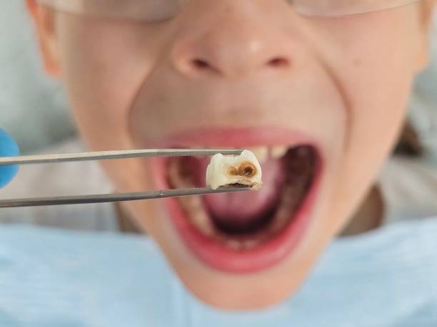 Best Same-Day Emergency Dental Services in Camden, AR
